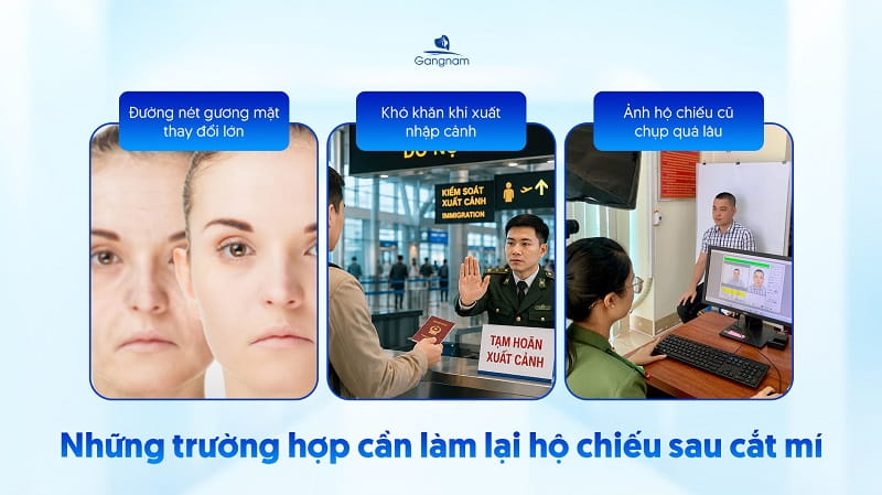 Cắt mí có phải làm lại hộ chiếu không? 5 Cắt mí có phải làm lại hộ chiếu không?