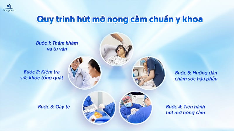 Hút mỡ nọng cằm là gì? Những điều cần lưu ý khi hút mỡ nọng cằm 6 Hút mỡ nọng cằm