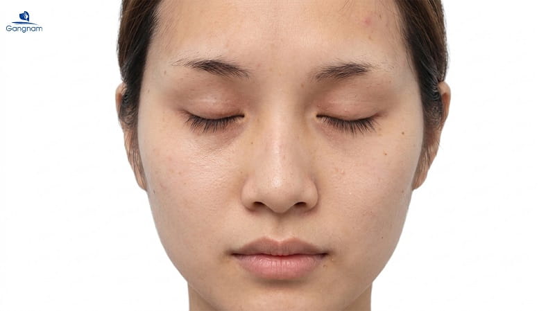 Lông mày đứt đoạn là gì? Tốt hay xấu? 7 Lông mày đứt đoạn là gì?