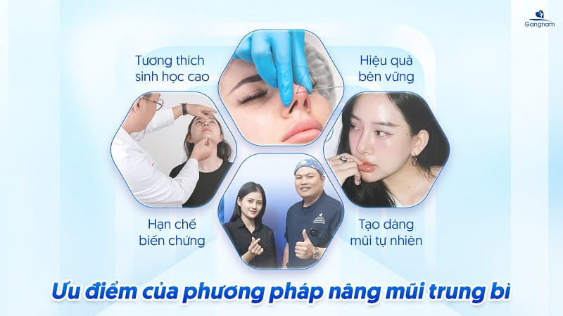 Nâng mũi bằng mỡ trung bì là gì? Giá bao nhiêu? 6 Nâng mũi bằng mỡ trung bì