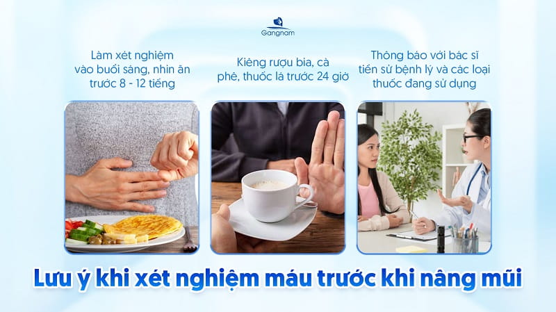 Nâng mũi có cần xét nghiệm máu không? 7 Nâng mũi có cần xét nghiệm máu không?