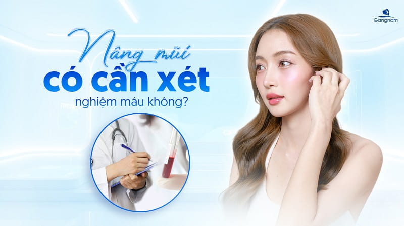 Nâng mũi có cần xét nghiệm máu không? 6 Nâng mũi có cần xét nghiệm máu không?