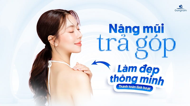 Nâng mũi trả góp là gì? Có nên nâng mũi trả góp không? 5 Nâng mũi trả góp