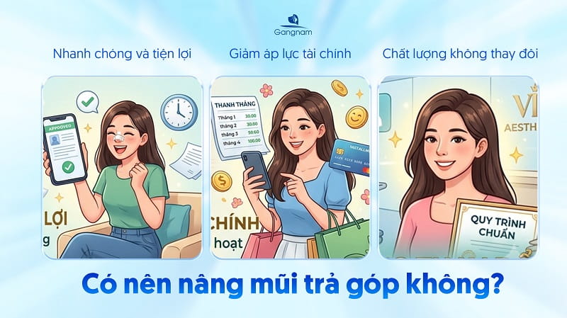 Nâng mũi trả góp là gì? Có nên nâng mũi trả góp không? 6 Nâng mũi trả góp