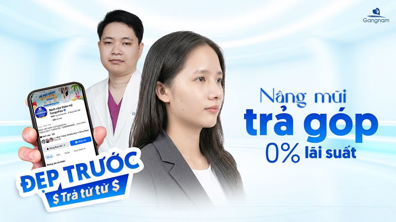 Nâng mũi trả góp là gì? Có nên nâng mũi trả góp không? 7 Nâng mũi trả góp