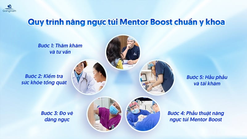 Nâng ngực túi Mentor Boost giá bao nhiêu? 8 Nâng ngực túi Mentor Boost