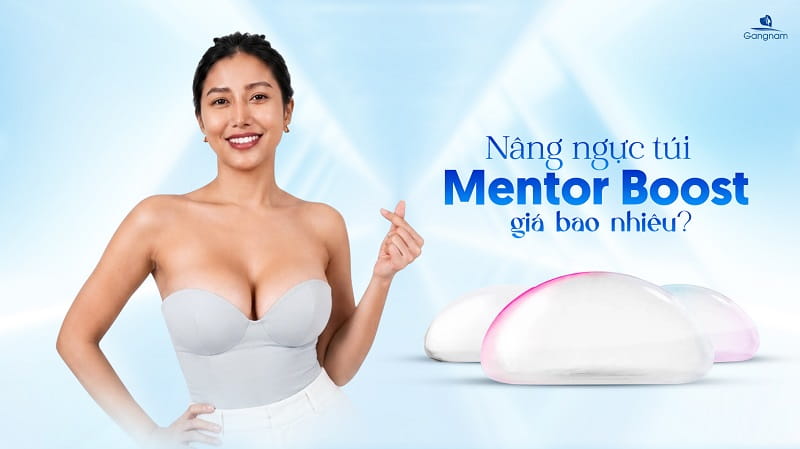 Nâng ngực túi Mentor Boost giá bao nhiêu? 6 Nâng ngực túi Mentor Boost