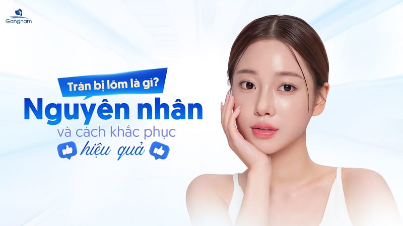 Trán bị lõm là gì? Nguyên nhân và cách khắc phục trán lõm hiệu quả 5 Trán bị lõm là gì?