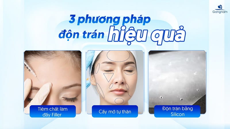 Trán bị lõm là gì? Nguyên nhân và cách khắc phục trán lõm hiệu quả 7 Trán bị lõm là gì?