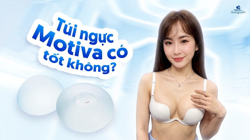 Túi ngực Motiva có tốt không? 6 Túi ngực Motiva có tốt không?