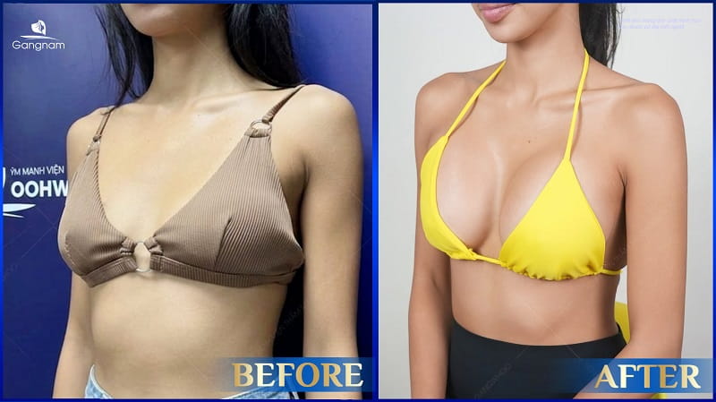Top 5 bài tập tăng vòng 1 hiệu quả 9 Bài tập tăng vòng 1