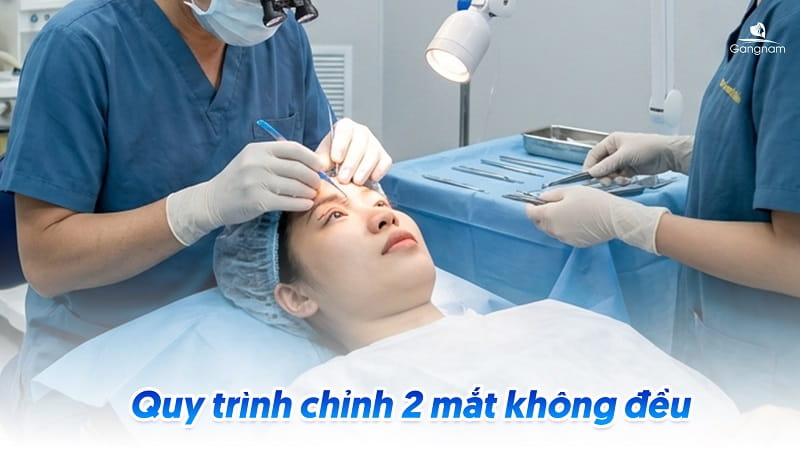 Chỉnh 2 mắt không đều - Khắc phục khuyết điểm mắt bên to bên nhỏ 7 Chỉnh 2 mắt không đều