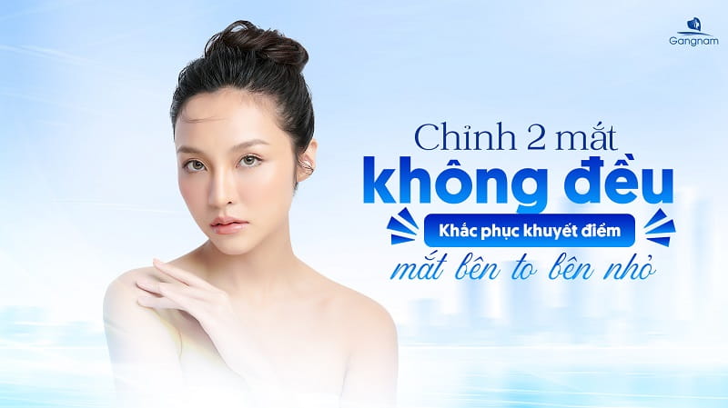 Chỉnh 2 mắt không đều - Khắc phục khuyết điểm mắt bên to bên nhỏ 5 Chỉnh 2 mắt không đều