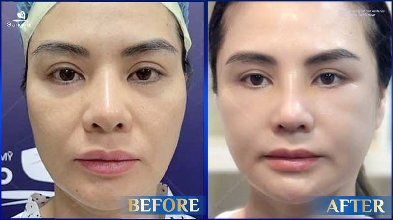 Độn thái dương có bị lộ không? 10 Độn thái dương có bị lộ không?