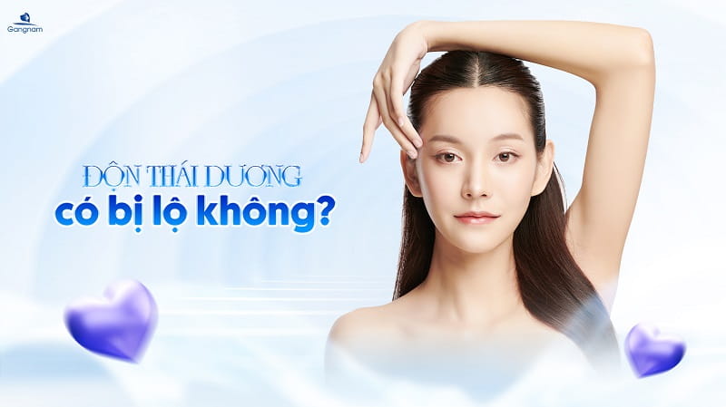 Độn thái dương có bị lộ không? 6 Độn thái dương có bị lộ không?