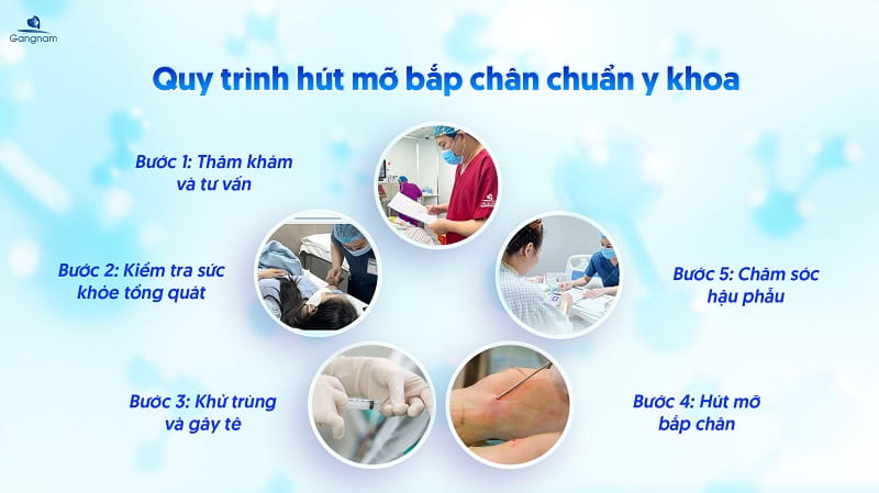 Hút mỡ bắp chân bao nhiêu tiền? 8 Hút mỡ bắp chân bao nhiêu tiền?