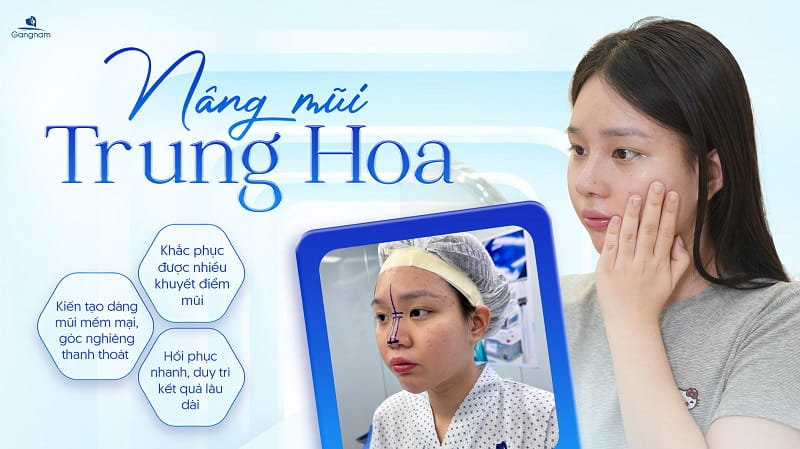 Nâng mũi dáng Trung Hoa - Xu hướng thẩm mỹ của giới trẻ 7 Nâng mũi dáng Trung Hoa