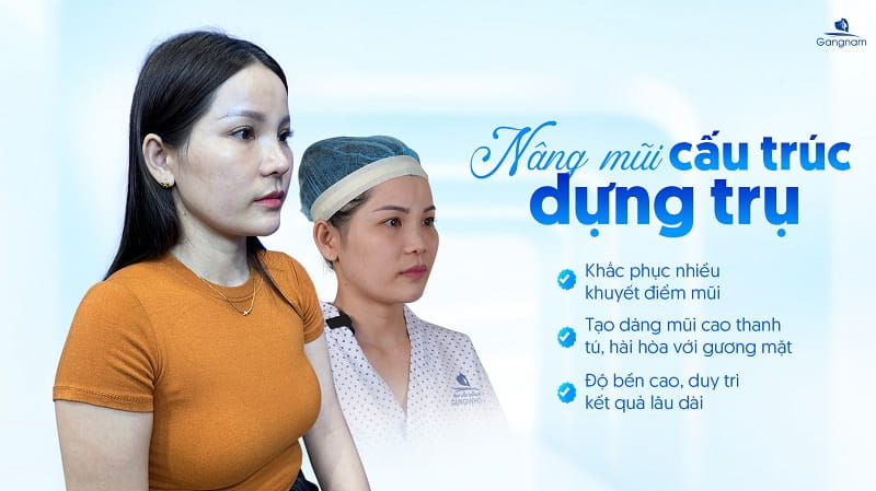 Nâng mũi dựng trụ là gì? Giá bao nhiêu? 7 Nâng mũi dựng trụ là gì?