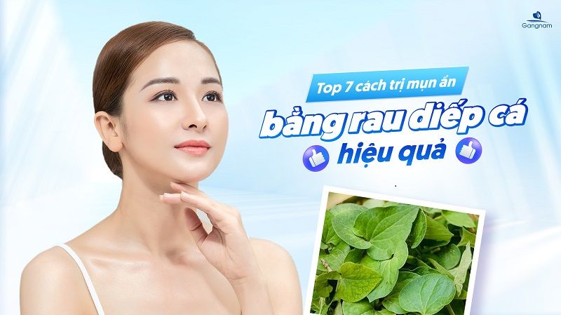 Top 7 cách trị mụn ẩn bằng rau diếp cá hiệu quả 5 Cách trị mụn ẩn bằng rau diếp cá