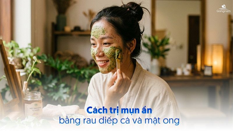 Top 7 cách trị mụn ẩn bằng rau diếp cá hiệu quả 6 Cách trị mụn ẩn bằng rau diếp cá