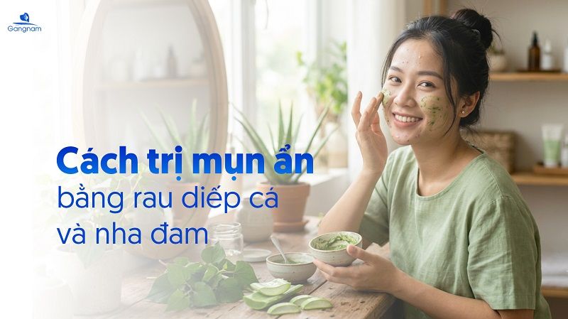 Top 7 cách trị mụn ẩn bằng rau diếp cá hiệu quả 7 Cách trị mụn ẩn bằng rau diếp cá