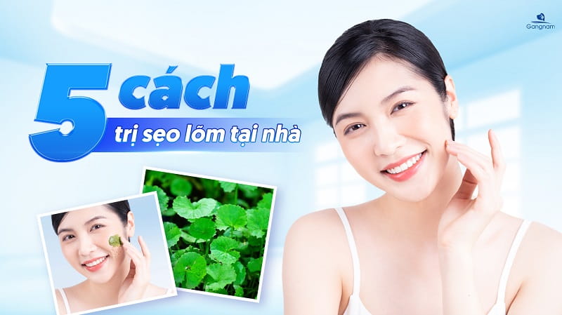 5 cách trị sẹo lõm bằng rau má hiệu quả 5 Cách trị sẹo lõm bằng rau má