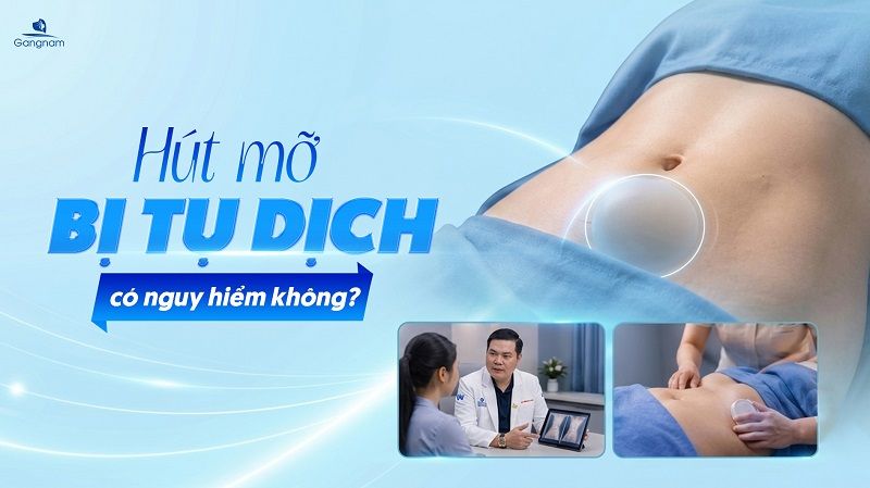 Hút mỡ bị tụ dịch có nguy hiểm không? 4 Hút mỡ bị tụ dịch