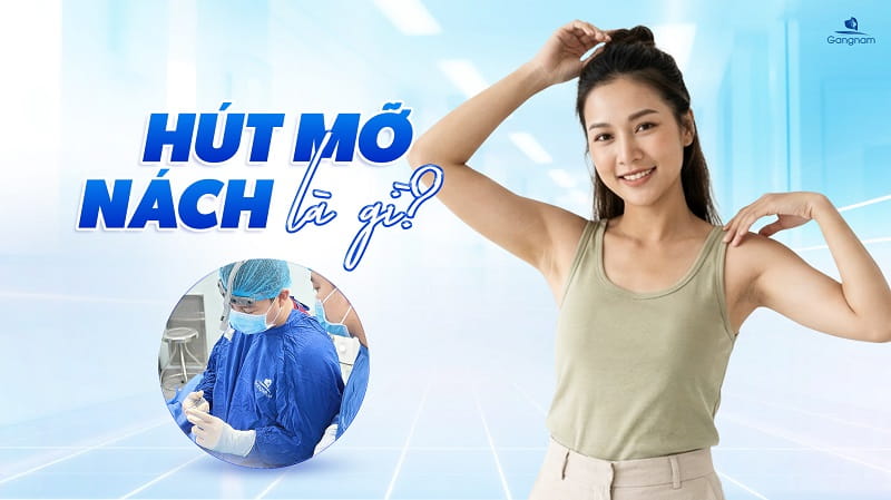 Hút mỡ nách là gì? Tìm hiểu cùng chuyên gia 5 Hút mỡ nách