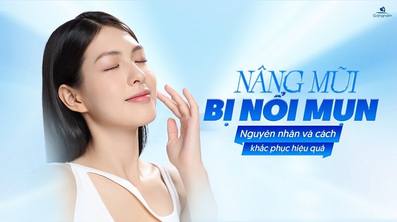 Nâng mũi bị nổi mụn có nguy hiểm không? 6 Nâng mũi bị nổi mụn