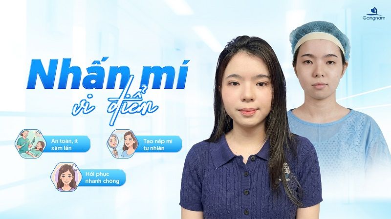 Nhấn mí vi điểm giữ được bao lâu? 7 Nhấn mí vi điểm