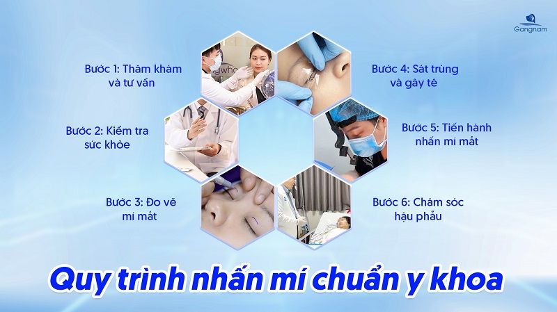 Nhấn mí vi điểm giữ được bao lâu? 8 Nhấn mí vi điểm