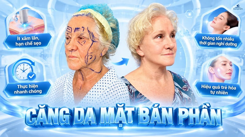 Căng da mặt bán phần là gì? Ưu điểm và những lưu ý quan trọng 6 Căng da mặt bán phần