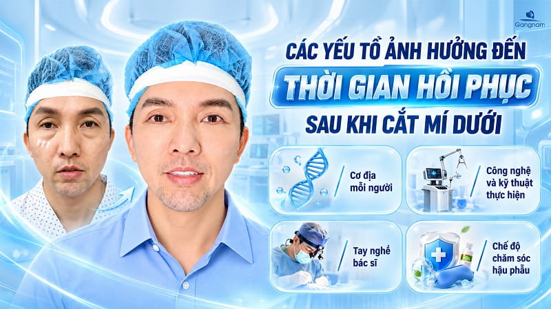 Cắt mí dưới bao lâu thì lành? Thời gian hồi phục chi tiết 6 Cắt mí dưới bao lâu thì lành?