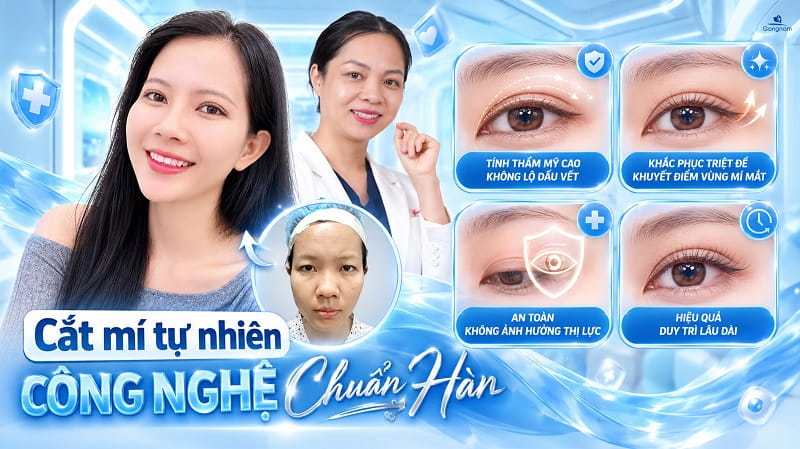 Cắt mí tự nhiên là gì? Ưu điểm và quy trình thực hiện 7 Cắt mí tự nhiên