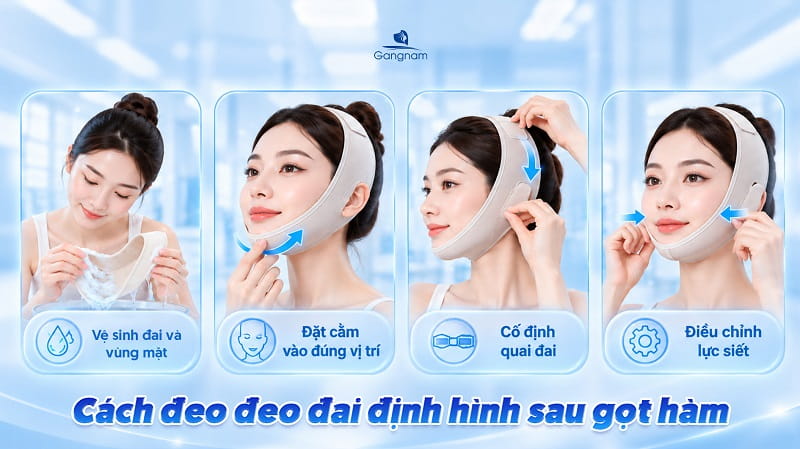Gọt hàm đeo đai định hình bao lâu? 8 Gọt hàm đeo đai định hình bao lâu?