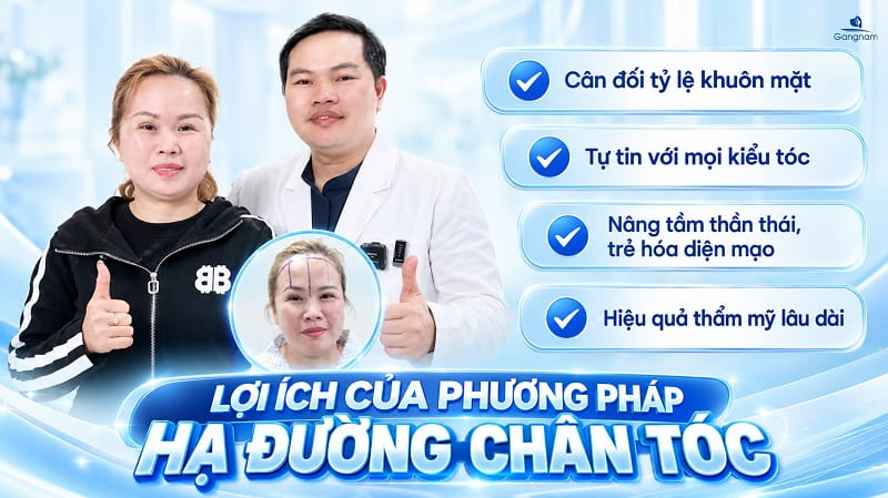 Hạ đường chân tóc là gì? Bí quyết sở hữu khuôn mặt cân đối, tỷ lệ vàng 6 Hạ đường chân tóc