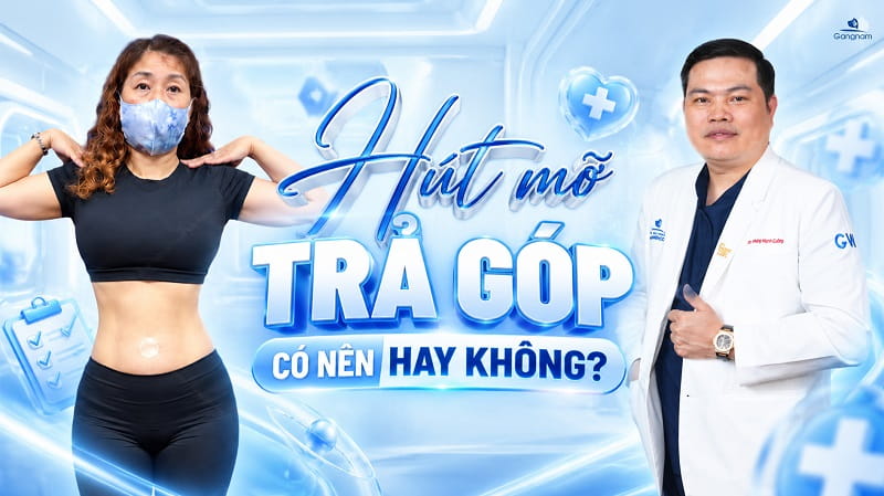 Hút mỡ trả góp: Giải pháp lấy lại vóc dáng thon gọn không lo tài chính 5 Hút mỡ trả góp