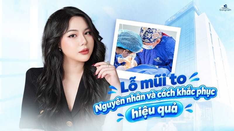 Lỗ mũi to - Nguyên nhân và cách khắc phục hiệu quả 6 Lỗ mũi to