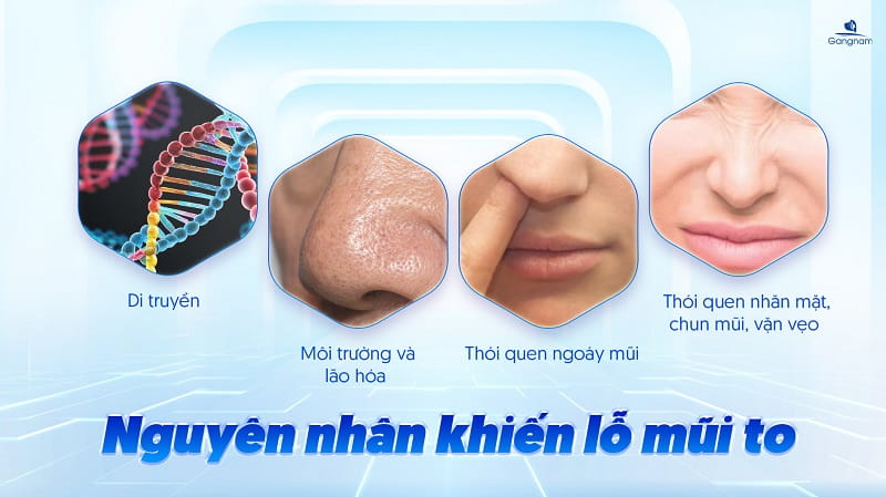 Lỗ mũi to - Nguyên nhân và cách khắc phục hiệu quả 7 Lỗ mũi to