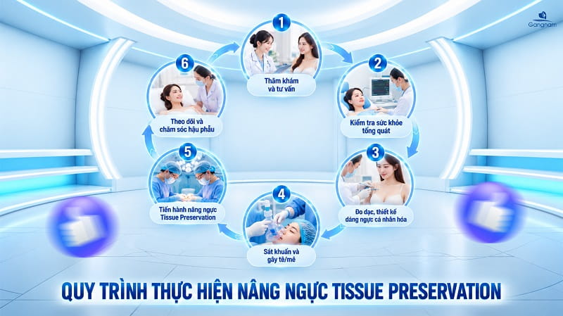 Nâng ngực Tissue Preservation là gì? Giải pháp thẩm mỹ vòng 1 ít xâm lấn, phục hồi nhanh 8 Nâng ngực Tissue Preservation