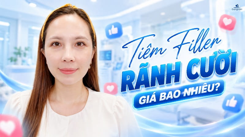 Tiêm Filler rãnh cười giá bao nhiêu? 5 Tiêm Filler rãnh cười giá bao nhiêu?