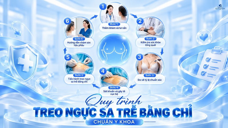 Treo ngực sa trễ bằng chỉ có hiệu quả không? 7 Treo ngực sa trễ bằng chỉ